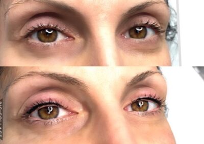 before and after lash extensions