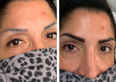 before and after microblading