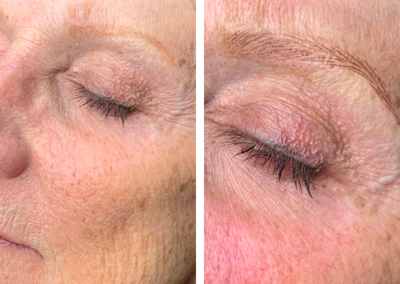 before and after microblading