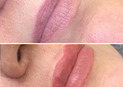 before and after lip blushing