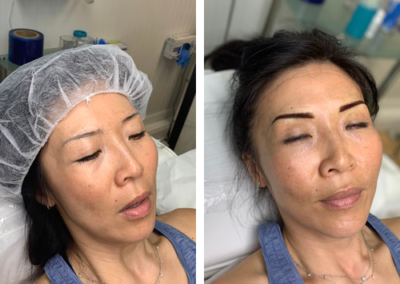 before and after microblading