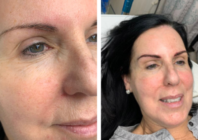 before and after microblading