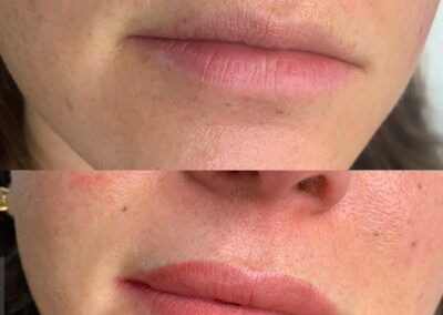 before and after lip blushing