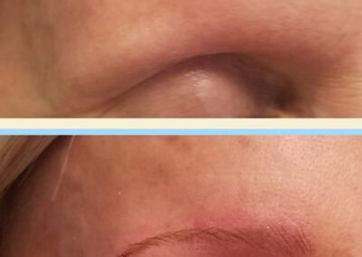 before and after microblading