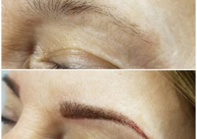 Microblading