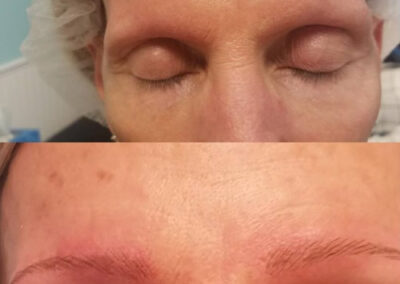 microblading